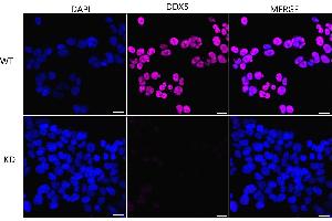 Immunocytochemical staining of HeLa cells using DDX5 antibody (ABIN7798288), 1:1,000), Top panel: wild-type (WT), Bottom panal: DDX5 shRNA knockdown (KD).