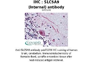 Image no. 1 for anti-Solute Carrier Family 5 (Sodium/glucose Cotransporter), Member 9 (SLC5A9) (Internal Region) antibody (ABIN1739410) (SLC5A9 anticorps  (Internal Region))