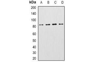 Western blot analysis of KCNN3 expression in Raji (A), mouse heart (B), mouse livere (C), rat brain (D) whole cell lysates.