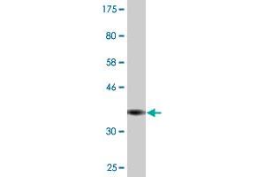 Western Blot detection against Immunogen (35.