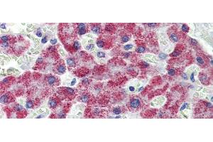Immunohistochemistry with Human Liver cell lysate tissue (ACAA1 anticorps  (N-Term))
