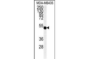 Western blot analysis of hGJA7-H104. (GJC1 anticorps  (N-Term))
