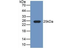 Western Blot; Sample: Recombinant FBLN1, Mouse. (Fibulin 1 anticorps  (AA 399-578))