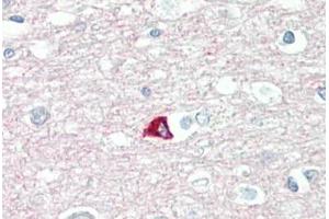 Image no. 2 for anti-Synaptosomal-Associated Protein, 25kDa (SNAP25) (AA 151-200) antibody (ABIN2879129)