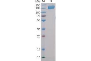 Human CD22, hFc-His Tag on SDS-PAGE under reducing condition. (CD22 Protein (Fc-His Tag))