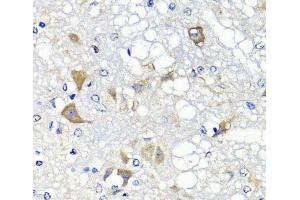 Immunohistochemistry of paraffin-embedded Rat brain using PSPH Polyclonal Antibody at dilution of 1:100 (40x lens). (PSPH anticorps)