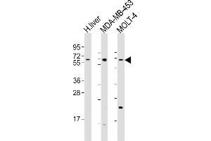 All lanes : Anti-OPN-a/b Antibody (N-term) at 1:1000 dilution Lane 1: human liver lysates Lane 2: MDA-MB-453 whole cell lysates Lane 3: MOLT-4 whole cell lysates Lysates/proteins at 20 μg per lane. (OPN-A,b (AA 14-40), (N-Term) anticorps)