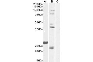 ABIN768639 (1µg/ml) staining of Mouse Testes lysate 1 (A) and Testes lysate 2 (B) + peptide (C) (35µg protein in RIPA buffer). (FGF23 anticorps  (Internal Region))