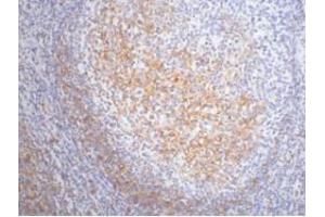 Immunohistochemistry (IHC) image for anti-Fc Fragment of IgE, Low Affinity II, Receptor For (CD23) (FCER2) antibody (ABIN3178602) (FCER2 anticorps)
