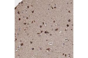 Immunohistochemical staining of human cerebral cortex with ODZ1 polyclonal antibody  shows strong cytoplasmic positivity in neuronal cells at 1:10-1:20 dilution. (ODZ1/Teneurin 1 anticorps)