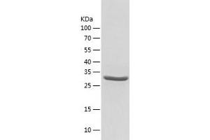 Western Blotting (WB) image for Sulfotransferase Family, Cytosolic, 2B, Member 1 (SULT2B1) (AA 1-311) protein (His tag) (ABIN7125240)