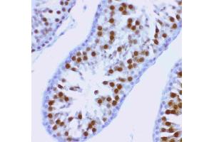 Anti-MCAK antibody, (ABIN3043278), IHC(P)IHC(P): Rat Testis Tissue