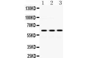 Western Blotting (WB) image for anti-Crossover junction endonuclease EME1 (EME1) (AA 520-561), (C-Term) antibody (ABIN3042370) (Crossover junction endonuclease EME1 (EME1) (AA 520-561), (C-Term) anticorps)