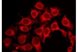 ABIN6277215 staining HepG2 by IF/ICC.