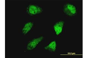 Immunofluorescence of monoclonal antibody to HOXD11 on HeLa cell. (HOXD11 anticorps  (AA 1-76))