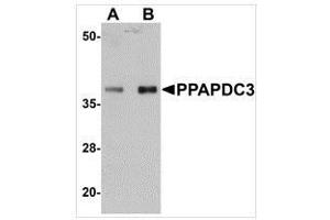 Western blot analysis of PPAPDC3 in mouse heart tissue lysate with PPAPDC3 antibody at (A) 1 and (B) 2 μg/ml. (PPAPDC3 anticorps  (N-Term))