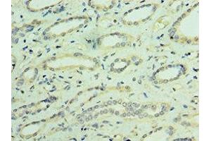 Immunohistochemistry of paraffin-embedded human kidney tissue using ABIN7172887 at dilution of 1:100