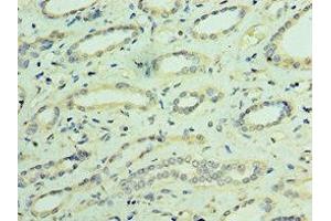 Immunohistochemistry of paraffin-embedded human kidney tissue using ABIN7172887 at dilution of 1:100 (TRPV4 anticorps  (AA 1-230))