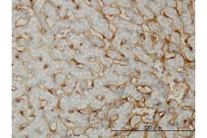 Immunoperoxidase of monoclonal antibody to EHD3 on formalin-fixed paraffin-embedded human liver. (EHD3 anticorps  (AA 357-406))