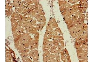 Immunohistochemistry of paraffin-embedded human heart tissue using ABIN7152571 at dilution of 1:100 (FDPS anticorps  (AA 1-419))