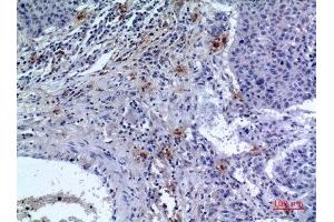 Immunohistochemistry (IHC) analysis of paraffin-embedded Human Lung, antibody was diluted at 1:100. (IREM1 anticorps  (Internal Region))