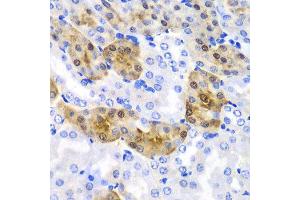 Immunohistochemistry of paraffin-embedded mouse kidney using HPD antibody at dilution of 1:100 (x40 lens). (HPD anticorps)