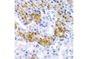 Immunohistochemistry of paraffin-embedded mouse kidney using HPD antibody at dilution of 1:100 (x40 lens).