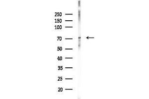 Western blot analysis of lysates from Rat brain, using Phospho-SYK (Tyr348) Antibody at 1/1000 dilution.