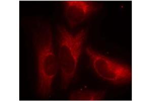 Image no. 3 for anti-14-3-3 zeta (YWHAZ) (pSer58) antibody (ABIN196916)