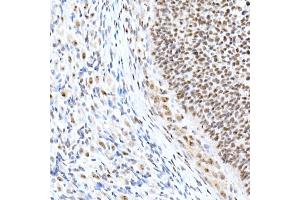Immunohistochemistry of paraffin-embedded rat ovary using Nucleolin Rabbit mAb (ABIN7269035) at dilution of 1:25 (40x lens). (Nucleolin anticorps)