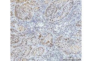 IHC analysis of FEN1 using anti-FEN1 antibody (ABIN7601619). (FEN1 anticorps  (AA 4-300))