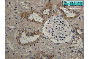 Formalin-fixed and paraffin embedded rat kidney labeled with Anti- HSD11B2 Polyclonal Antibody, Unconjugated at 1:200 followed by conjugation to the secondary antibody and DAB staining
