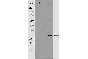 Western blot analysis of XBP1 expression in HepG2 cell lysate,The lane on the left is treated with the antigen-specific peptide. (XBP1 anticorps  (C-Term))
