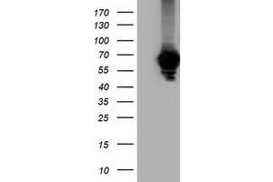 HEK293T cells were transfected with the pCMV6-ENTRY control (Left lane) or pCMV6-ENTRY AFP (Right lane) cDNA for 48 hrs and lysed. (alpha Fetoprotein anticorps)