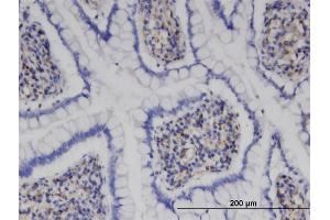 Immunoperoxidase of monoclonal antibody to MPHOSPH9 on formalin-fixed paraffin-embedded human small Intestine. (MPHOSPH9 anticorps  (AA 922-1031))