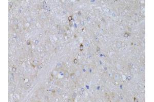 Immunohistochemistry of paraffin-embedded mouse brain using RARA antibody (ABIN5970142) at dilution of 1/100 (40x lens).