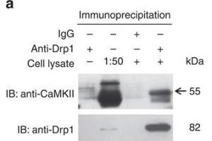 CaMKII binds and directly phosphorylates Drp1 at S616. (CAMK2D anticorps)