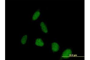 Immunofluorescence of purified MaxPab antibody to PSD on HeLa cell.