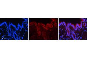 CALR antibody - C-terminal region (ARP30114_P050) Catalog Number: ARP30114_P050  Formalin Fixed Paraffin Embedded Tissue: Human Bronchial Epithelial Tissue  Observed Staining: Cytoplasm and membrane of bronchial epithelial tissue Primary Antibody Concentration: 1:100 Secondary Antibody: Donkey anti-Rabbit-Cy3  Secondary Antibody Concentration: 1:200  Magnification: 20X  Exposure Time: 0.