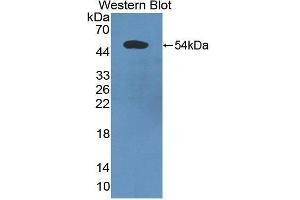 Western Blotting (WB) image for anti-Programmed Cell Death 6 Interacting Protein (PDCD6IP) (AA 174-383) antibody (ABIN1869717)