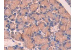 Detection of SPTAN1 in Rat Pancreas Tissue using Polyclonal Antibody to Alpha-Fodrin (SPTAN1)