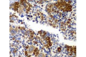 Immunohistochemistry of paraffin-embedded Rat spleen using PRKAB1 Polyclonal Antibody at dilution of 1:100 (40x lens).
