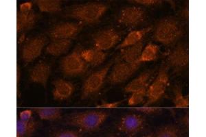 Immunofluorescence analysis of C6 cells using CREB3 Polyclonal Antibody at dilution of 1:100. (CREB3 anticorps)