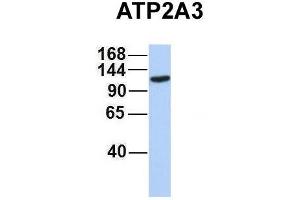 Host:  Rabbit  Target Name:  ATP2A3  Sample Type:  MCF7  Antibody Dilution:  1. (ATP2A3 anticorps  (Middle Region))