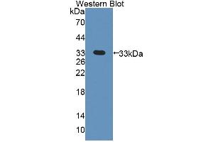 Western blot analysis of the recombinant protein. (PDK3 anticorps  (AA 138-396))