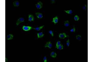 Immunofluorescence staining of MCF7 Cells with ABIN7127572 at 1:50, counter-stained with DAPI.