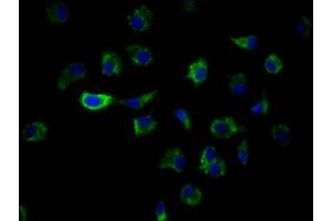 Immunofluorescence staining of MCF7 Cells with ABIN7127572 at 1:50, counter-stained with DAPI. (Recombinant ILK anticorps)