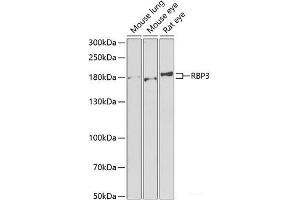 Western blot analysis of extracts of various cell lines using RBP3 Polyclonal Antibody at dilution of 1:1000. (RBP3 anticorps)