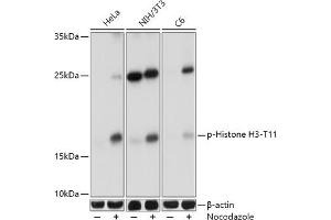Western blot analysis of extracts of various cell lines, using Phospho-Histone H3-T11 antibody (ABIN3023615, ABIN3023616, ABIN3023617 and ABIN6225469) at 1:1000 dilution. (Histone 3 anticorps  (pThr11))