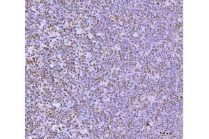 IHC analysis of GLIS1 using anti-GLIS1 antibody (ABIN7599501).